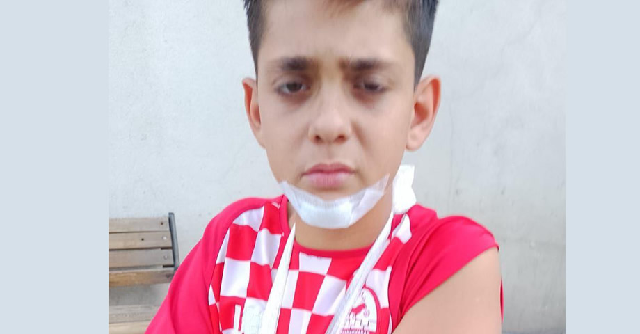 Kahramanmaraşspor U14 Oyuncusu Bilal Yarım’dan Talihsiz Sakatlık